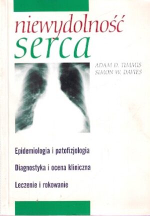 Niewydolność serca